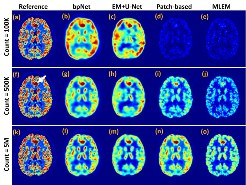 Researchers Propose Novel Deep Learning Method For Positron Emission Tomography Imaging Reconstruction Chinese Academy Of Sciences